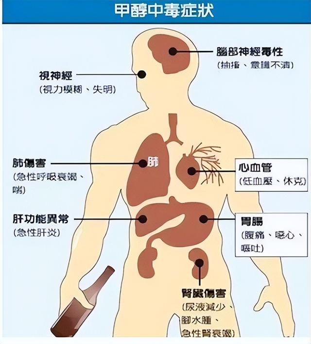 甲醛的中毒症状很多.jpeg