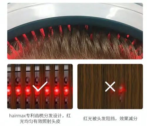 生发仪什么牌子好？Hairmax用科技为广大脱发人群解忧