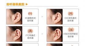 在什么地方可以买到助听器？